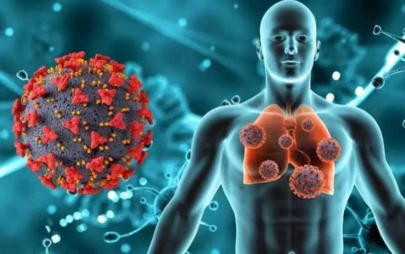 Van 273 muertos por neumonías en el estado