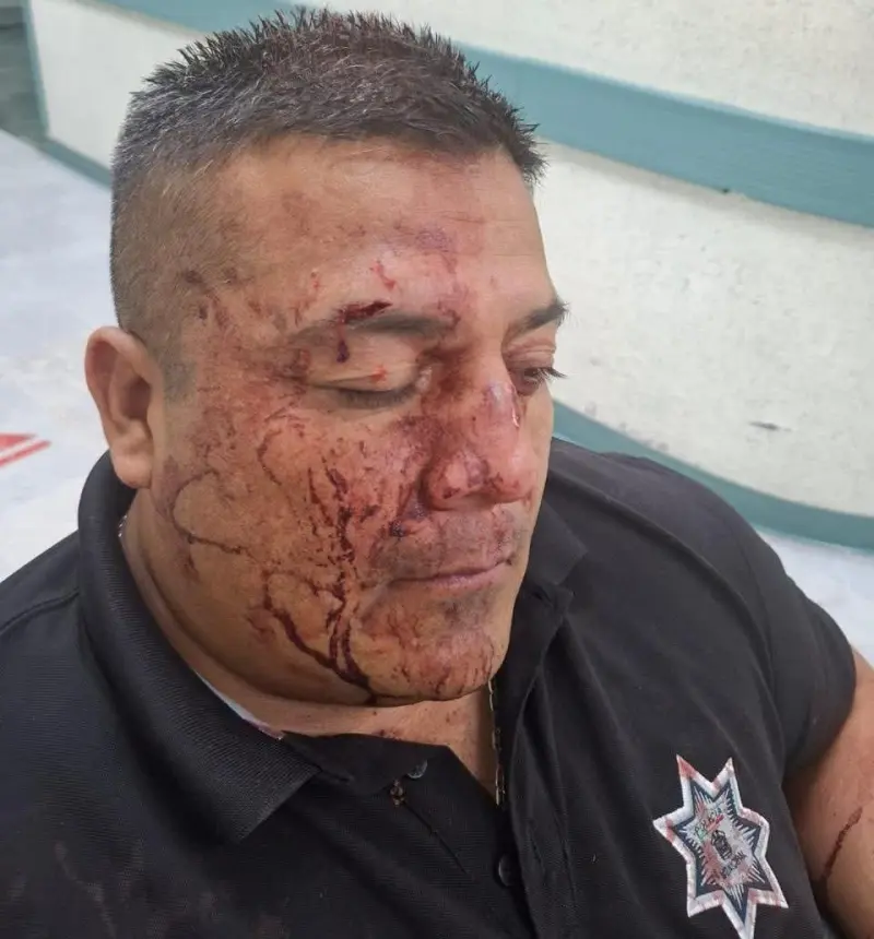 Agreden civiles a policías municipales en Metepec; hay 5 detenidos