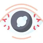 Secretaría de Salud de Querétaro promueve la detección temprana del glaucoma