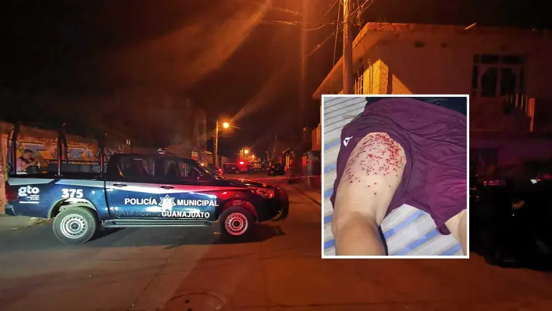 Discusión termina mal: Lo atacan con escopeta “chispera” tras fuerte riña en Acámbaro