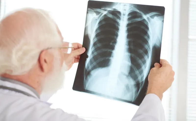 Registra Nueva York descenso de casos de tuberculosis durante el 2025