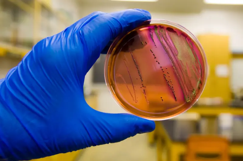 México alerta de brote de Escherichia coli O157:H7 asociado a una marca de quesos y leche en EE.UU.