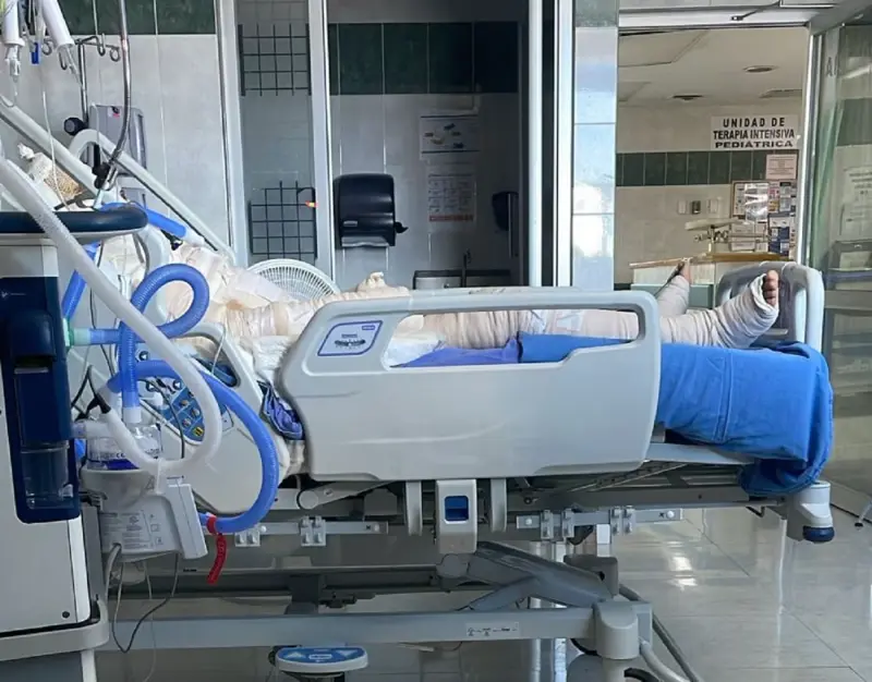 Trasladan a hombre con quemaduras graves de Tijuana a Chihuahua; familia pide apoyo