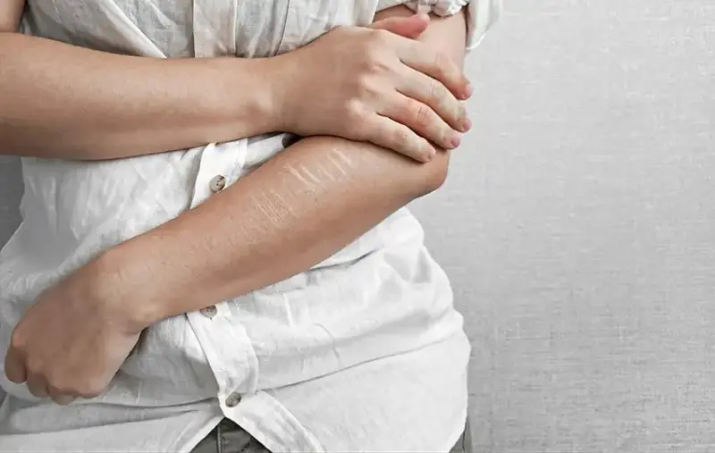 Alerta por casos de “cutting”, en Tizimín