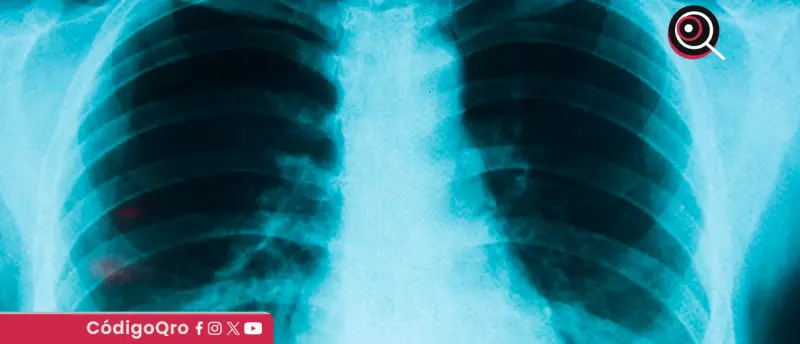 Conmemoran Día Nacional Contra Cáncer de Pulmón