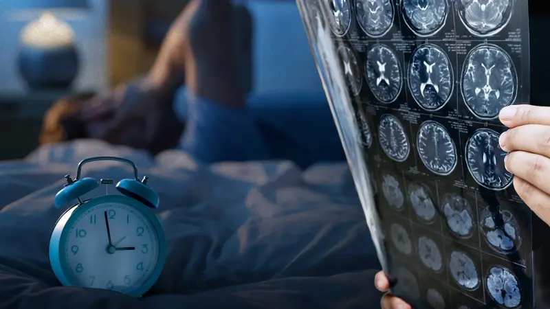 ¿Duermes bien? 3 Enfermedades que podrías desarrollar por no tener una buena higiene del sueño