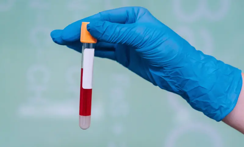 Desarrollan prueba de sangre económica para detectar varios cánceres