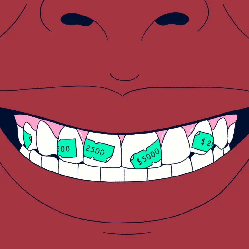 ¿Una caries siempre necesita empaste?