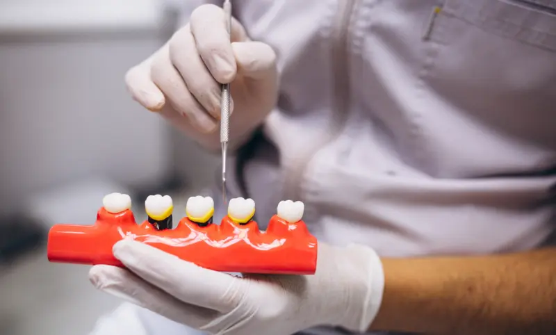 Descubren por qué fallan antibióticos en implantes dentales