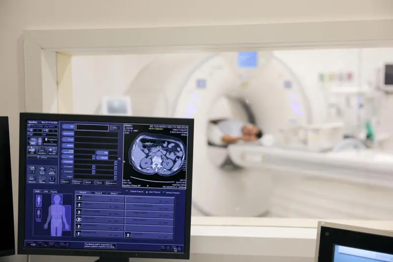 Nuevo Hospital O’Horán refuerza diagnósticos con tomógrafo de última generación