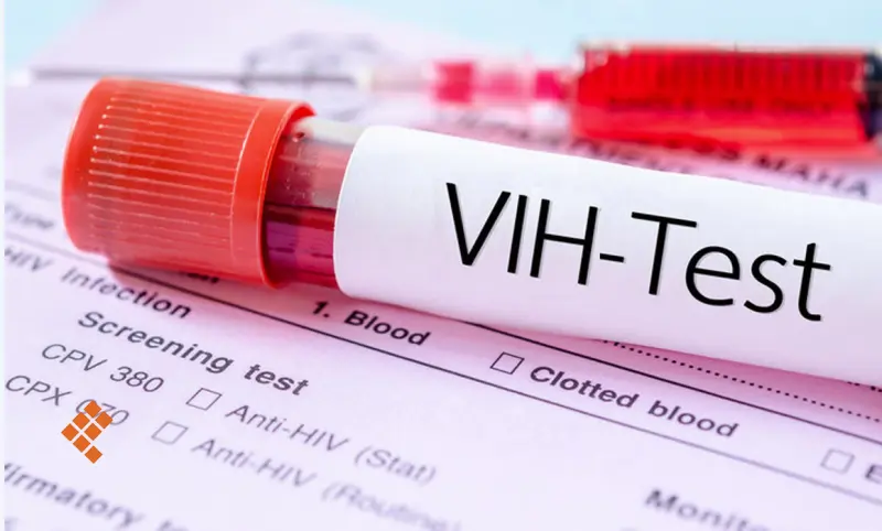 Aumento de VIH en Yucatán es por más pruebas y detección: Repavih