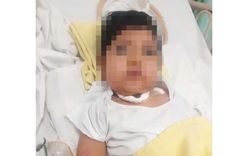Piden apoyo para Ángel, necesita aspirador eléctrico para continuar su tratamiento