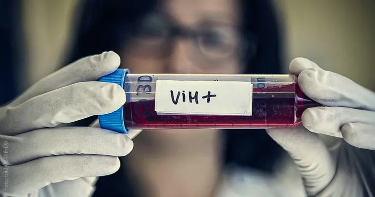 Servicios de Salud impulsan la PrEP para prevenir el VIH en SLP