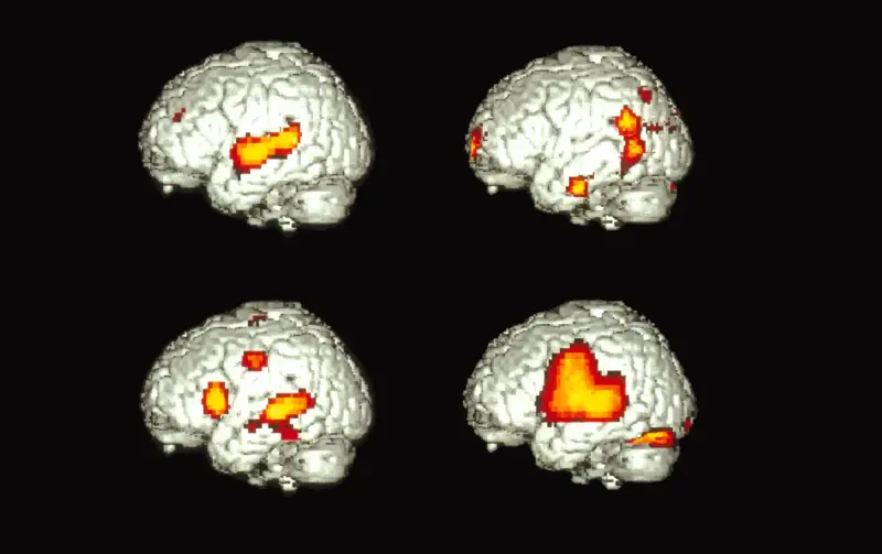 ¿Cómo puede un solo cerebro hablar dos idiomas?