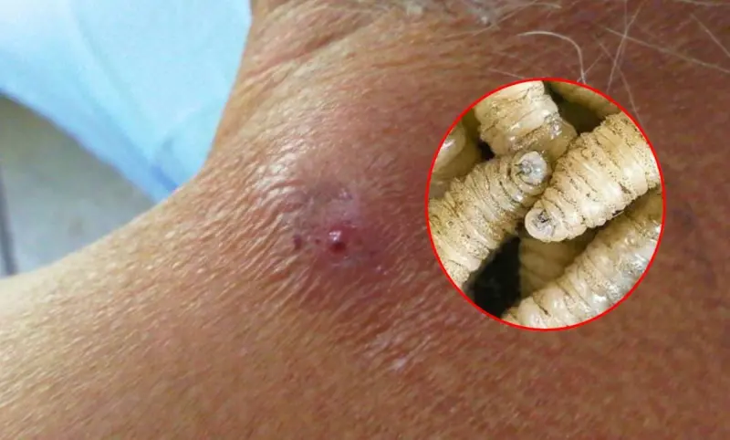 Alerta sanitaria por gusano barrenador sigue activa en Querétaro