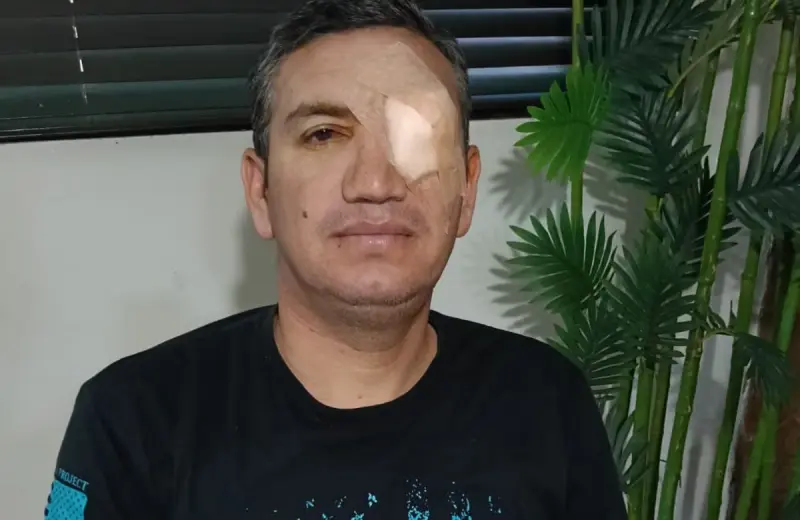 Familia organiza venta de barbacoa para cubrir gastos médicos de César Tánori tras operaciones oculares