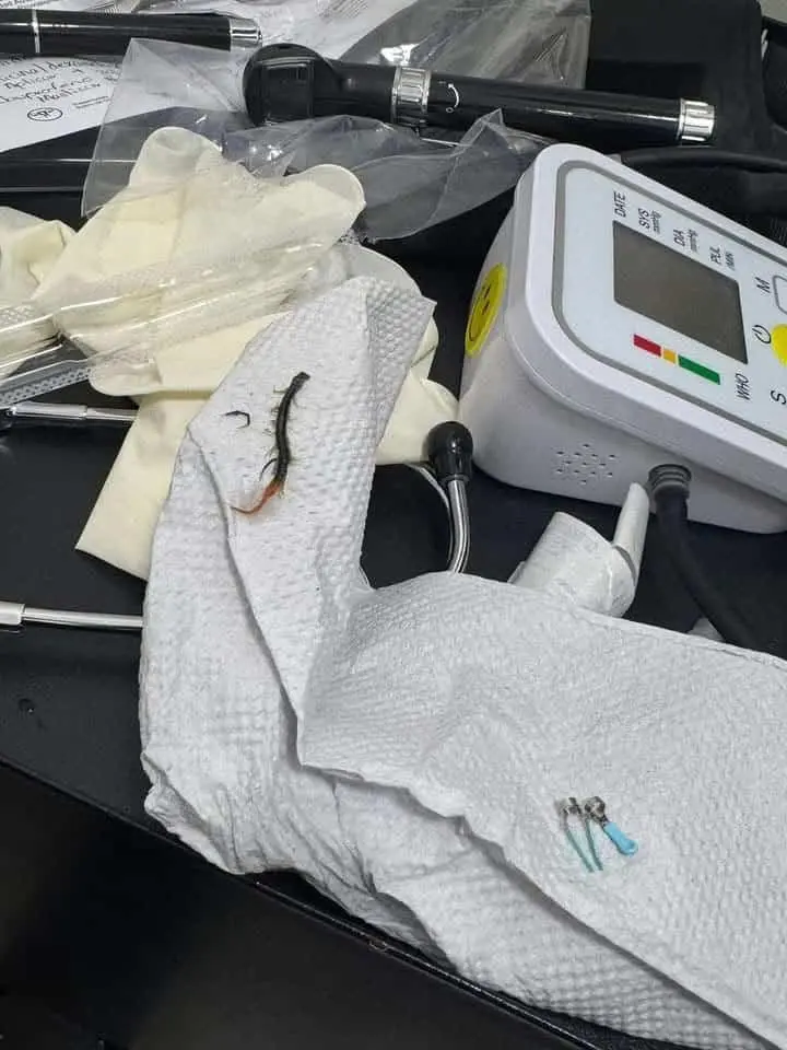 Extraen un ciempiés del oído de una niña de 4 años tras segunda valoración médica en Acuña