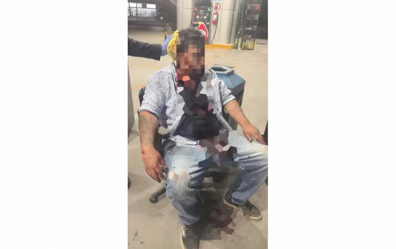 Atacan a amigo de parranda y lo dejan lesionado