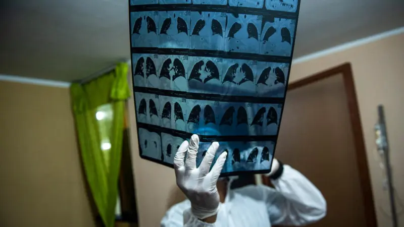 CNA multa con 59.6 millones de pesos a empresas por colusión en licitaciones de material para radiografías