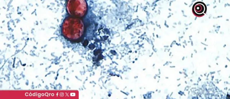 Qué es la ciclosporiasis, la infección detrás del brote de "diarrea explosiva" en EUA