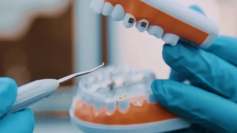 Facultad de Odontología de la UAdeC ofrecerá servicios dentales durante el verano, en Torreón