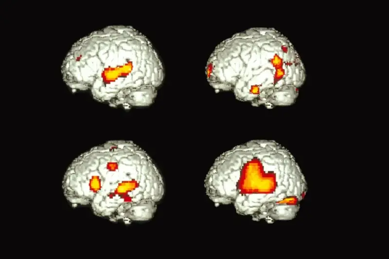 ¿Cómo puede un solo cerebro hablar dos idiomas?