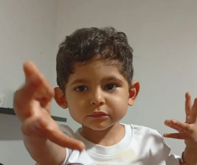 Madre pide apoyo para costear tratamiento de niño con malformaciones congénitas en Tijuana