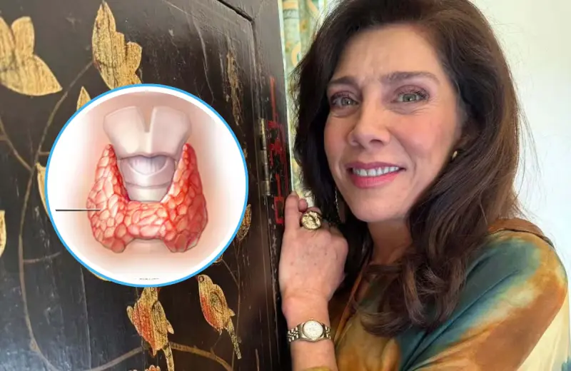 ¿Qué es la enfermedad de Hashimoto? La enfermedad incurable que Cynthia Klitbo reveló tener