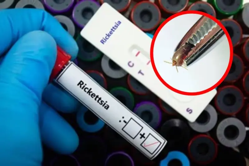 Sonora suma 32 muertes por fiebre manchada derivada de rickettsia