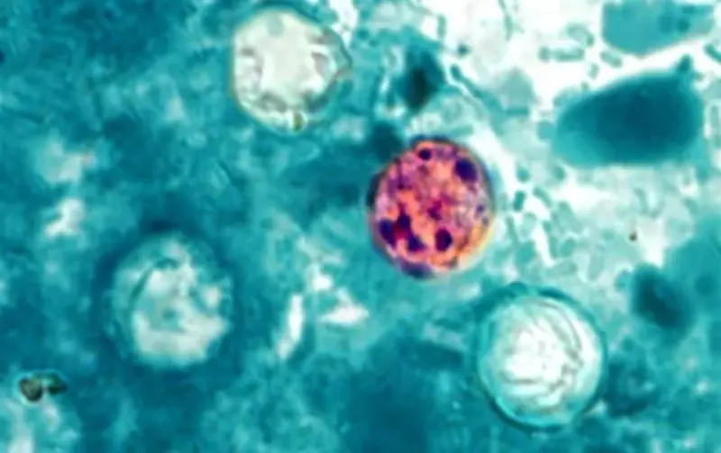 Mueren dos personas en Michigan por brote de ciclosporiasis