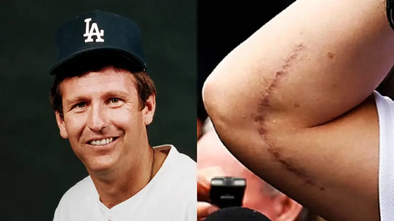 Muere Tommy John a los 83 años: el pitcher que dio nombre a la cirugía más famosa del beisbol