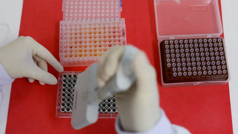 Descarta Secretaría de Salud un brote activo de ciclosporiasis en el país