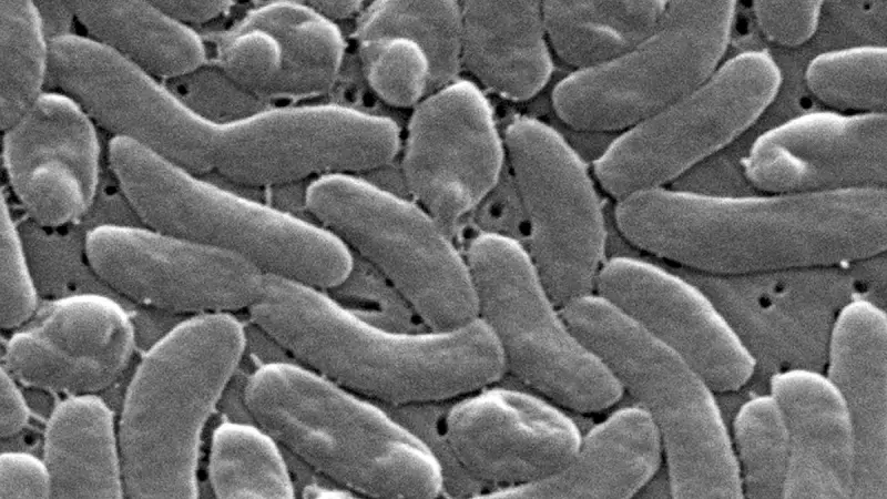 Advierten por bacteria ‘devoradora de carne’, que incluso lleva a la muerte en EU