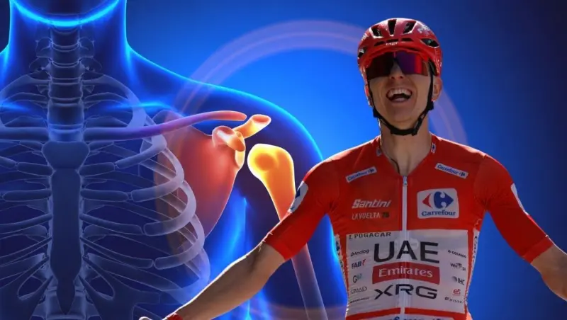 ¿Qué tan grave es la lesión de Tadej Poga?ar? Así sería la recuperación del campeón del Tour de Francia