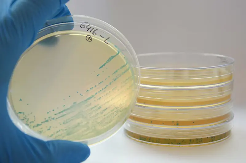 El peligro invisible en tu refrigerador: Qué es la listeria, por qué no altera el sabor de la comida y cómo evitar la infección