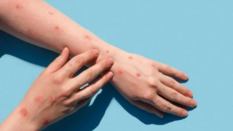 Cuál es la peligrosa infección que aumenta más de 30% el riesgo de infarto y accidente cerebrovascular