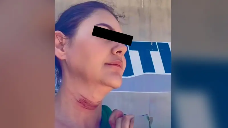 Mujer se quita la vida tras cirugía mal realizada en Tijuana