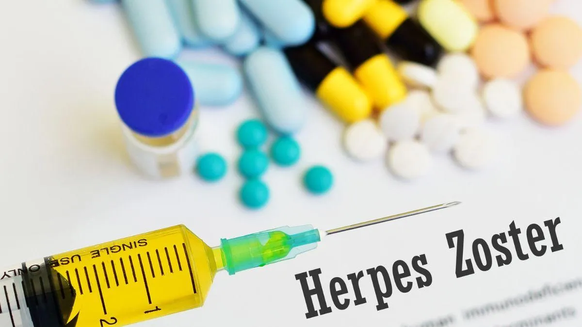 ¿Cuánto vive el virus del herpes zóster fuera del cuerpo y cómo prevenir su contagio?