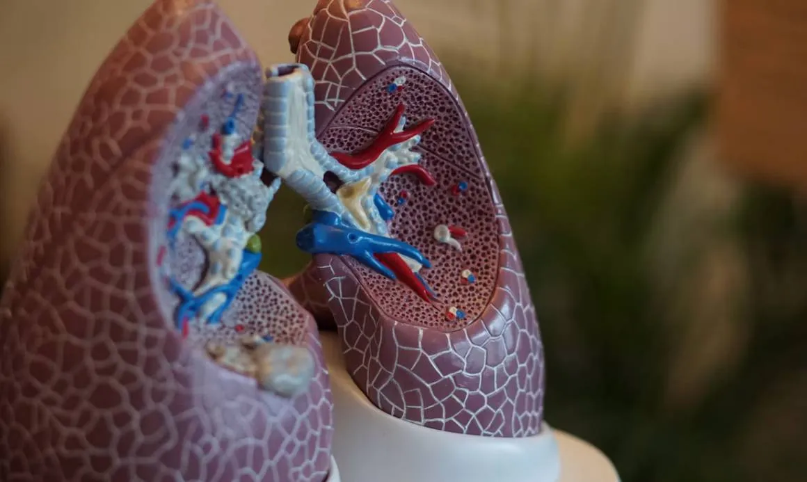 Explican qué es el adenocarcinoma pulmonar del papa León XIV