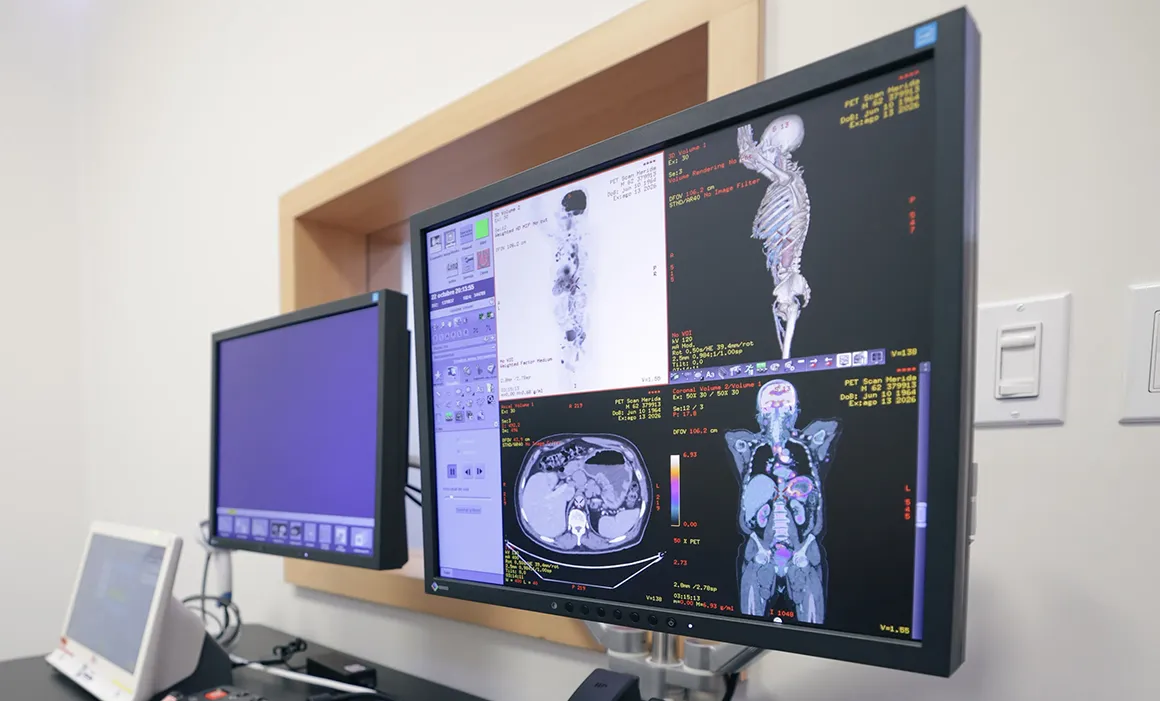 Yucatán ya cuenta con un PET-CT de 128 cortes, en la Clínica de Mérida 