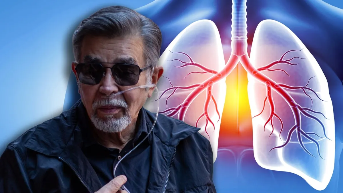Jorge Ortiz de Pinedo revela por qué no le pueden trasplantar un pulmón: ‘Fumé, tuve cáncer dos veces’