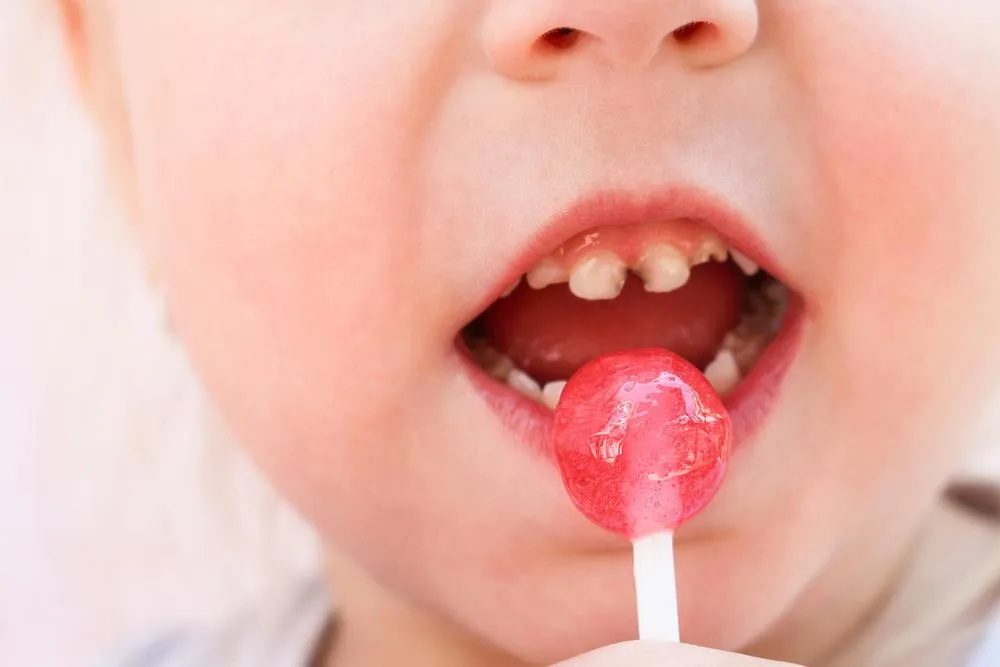 Ante Halloween, se prevé alza de 50% en consultas infantiles por caries
