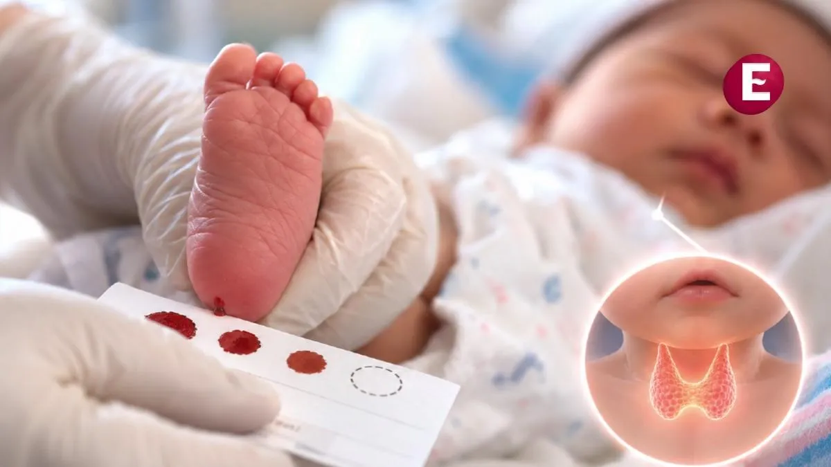 Tamiz neonatal, la herramienta clave para la detección temprana de hipotiroidismo